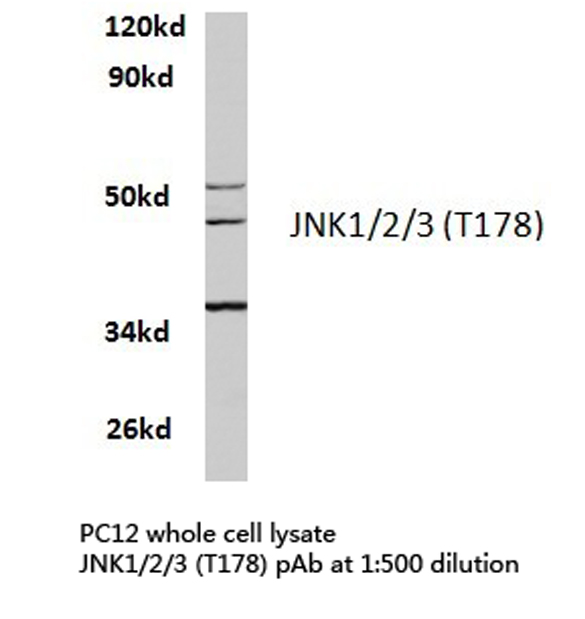 JNK1+2+3 Antibody - Western blot of JNK1/2/3 (T178) pAb in extracts from HeLa and PC12 cells.