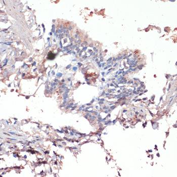 JNK1/2 Antibody - Immunohistochemistry of paraffin-embedded Human lung using c-Jun Polyclonal Antibody at dilution of 1:100 (40x lens).