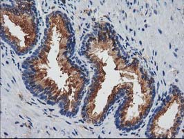 JOSD1 Antibody - IHC of paraffin-embedded Human prostate tissue using anti-JOSD1 mouse monoclonal antibody. (Heat-induced epitope retrieval by 10mM citric buffer, pH6.0, 100C for 10min).