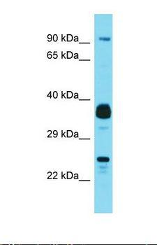 JOSD1 Antibody - Western blot of Human MCF7. JOSD1 antibody dilution 1.0 ug/ml.  This image was taken for the unconjugated form of this product. Other forms have not been tested.