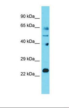 JOSD1 Antibody - Western blot of Human Fetal Lung. JOSD1 antibody dilution 1.0 ug/ml.  This image was taken for the unconjugated form of this product. Other forms have not been tested.