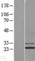 JOSD1 Protein - Western validation with an anti-DDK antibody * L: Control HEK293 lysate R: Over-expression lysate