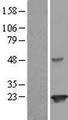 JOSD2 Protein - Western validation with an anti-DDK antibody * L: Control HEK293 lysate R: Over-expression lysate