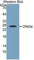 JPH1 Antibody - Western blot of JPH1 antibody.