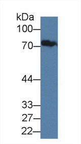 JPH1 Antibody - Western Blot; Sample: Human Serum; Primary Ab: 1µg/ml Rabbit Anti-Human JPH1 Antibody Second Ab: 0.2µg/mL HRP-Linked Caprine Anti-Rabbit IgG Polyclonal Antibody