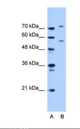 JPH1 Antibody - Lane A: Marker. Lane B: Jurkat cell lysate. Antibody concentration: 5.0 ug/ml. Gel concentration: 12%.  This image was taken for the unconjugated form of this product. Other forms have not been tested.