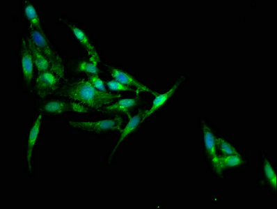 JPH1 Antibody - Immunofluorescence staining of Hela cells at a dilution of 1:100, counter-stained with DAPI. The cells were fixed in 4% formaldehyde, permeabilized using 0.2% Triton X-100 and blocked in 10% normal Goat Serum. The cells were then incubated with the antibody overnight at 4 °C.The secondary antibody was Alexa Fluor 488-congugated AffiniPure Goat Anti-Rabbit IgG (H+L) .