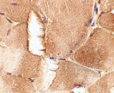 JPH1 Antibody - Immunohistochemistry of JPH1 in mouse skeletal muscle tissue with JPH1 antibody at 2.5 ug/ml.