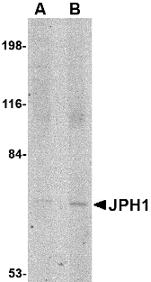 JPH1 Antibody - Western blot of JPH1 in 293 cell lysate with JPH1 antibody at (A) 1 and (B) 2 ug/ml