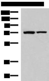 JPH1 Antibody - Western blot analysis of Mouse heart tissue and Mouse skeletal muscle tissue lysates  using JPH1 Polyclonal Antibody at dilution of 1:800