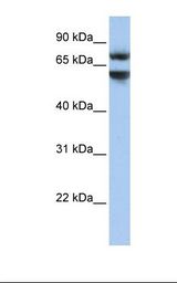 JPH3 Antibody - HepG2 cell lysate. Antibody concentration: 1.0 ug/ml. Gel concentration: 12%.  This image was taken for the unconjugated form of this product. Other forms have not been tested.