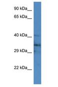 JPH4 Antibody - JPH4 antibody Western Blot of Mouse Brain. Antibody dilution: 1 ug/ml.  This image was taken for the unconjugated form of this product. Other forms have not been tested.