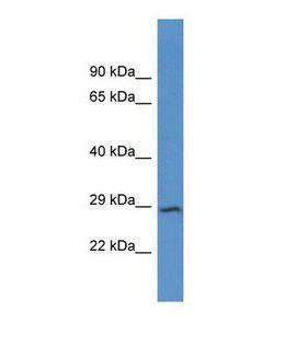 JPH4 Antibody - Western blot of Human U937. JPH4 antibody dilution 1.0 ug/ml.  This image was taken for the unconjugated form of this product. Other forms have not been tested.