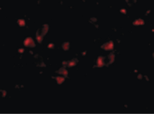 JPH4 Antibody - Immunofluorescence of JPH4 in Human Brain cells with JPH4 antibody at 20 ug/ml.