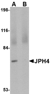 JPH4 Antibody - Western blot of JPH4 in 293 cell lysate with JPH4 antibody at 1 ug/ml in (A) the absence and (B) the presence of blocking peptide