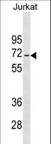 JRKL Antibody - JRKL Antibody western blot of Jurkat cell line lysates (35 ug/lane). The JRKL antibody detected the JRKL protein (arrow).