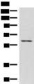 JRKL Antibody - Western blot analysis of K562 cell lysate  using JRKL Polyclonal Antibody at dilution of 1:1000