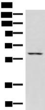JRKL Antibody - Western blot analysis of K562 cell lysate  using JRKL Polyclonal Antibody at dilution of 1:1000