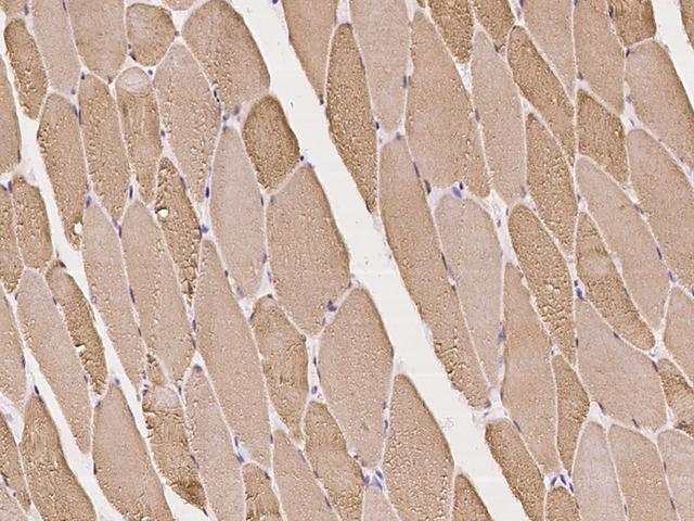 JSRP1 Antibody - Immunochemical staining of human JSRP1 in human skeletal muscle with rabbit polyclonal antibody at 1:100 dilution, formalin-fixed paraffin embedded sections.