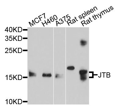 JTB / PAR Antibody - Western blot analysis of extracts of various cell lines, using JTB antibody at 1:1000 dilution. The secondary antibody used was an HRP Goat Anti-Rabbit IgG (H+L) at 1:10000 dilution. Lysates were loaded 25ug per lane and 3% nonfat dry milk in TBST was used for blocking. An ECL Kit was used for detection and the exposure time was 60s.