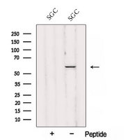 JUB / Ajuba Antibody - Western blot analysis of extracts of SGC cells using Ajuba antibody. The lane on the left was treated with blocking peptide.