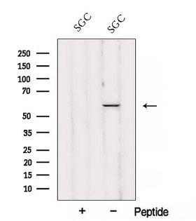 JUB / Ajuba Antibody - Western blot analysis of extracts of SGC cells using Ajuba antibody. The lane on the left was treated with blocking peptide.