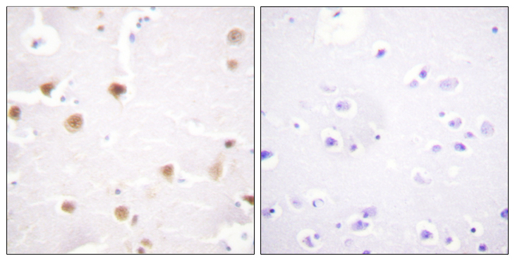 JUN / c-Jun Antibody - Immunohistochemistry analysis of paraffin-embedded human brain tissue, using c-Jun Antibody. The picture on the right is blocked with the synthesized peptide.