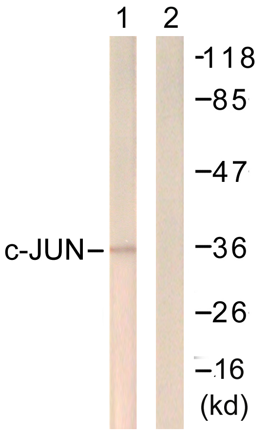 JUN / c-Jun Antibody - Western blot analysis of lysates from Jurkat cells, treated with UV 15', using c-Jun Antibody. The lane on the right is blocked with the synthesized peptide.