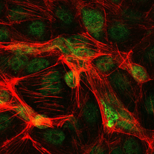 JUN / c-Jun Antibody - Immunofluorescence of PC-2 cells using c-Jun mouse monoclonal antibody (green). Red: Actin filaments have been labeled with Alexa Fluor-555 phalloidin.