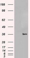 JUN / c-Jun Antibody - HEK293T cells were transfected with the pCMV6-ENTRY control (Left lane) or pCMV6-ENTRY C-Jun (Right lane) cDNA for 48 hrs and lysed. Equivalent amounts of cell lysates (5 ug per lane) were separated by SDS-PAGE and immunoblotted with anti-C-Jun.