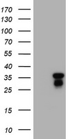 JUN / c-Jun Antibody - HEK293T cells were transfected with the pCMV6-ENTRY control (Left lane) or pCMV6-ENTRY JUN (Right lane) cDNA for 48 hrs and lysed. Equivalent amounts of cell lysates (5 ug per lane) were separated by SDS-PAGE and immunoblotted with anti-JUN.