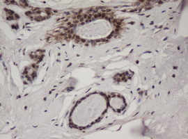 JUN / c-Jun Antibody - IHC of paraffin-embedded Human breast tissue using anti-JUN mouse monoclonal antibody.
