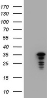 JUN / c-Jun Antibody - HEK293T cells were transfected with the pCMV6-ENTRY control (Left lane) or pCMV6-ENTRY JUN (Right lane) cDNA for 48 hrs and lysed. Equivalent amounts of cell lysates (5 ug per lane) were separated by SDS-PAGE and immunoblotted with anti-JUN.