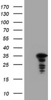 JUN / c-Jun Antibody - HEK293T cells were transfected with the pCMV6-ENTRY control (Left lane) or pCMV6-ENTRY JUN (Right lane) cDNA for 48 hrs and lysed. Equivalent amounts of cell lysates (5 ug per lane) were separated by SDS-PAGE and immunoblotted with anti-JUN.