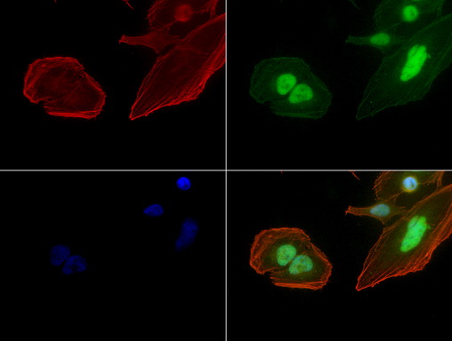JUN / c-Jun Antibody - Immunofluorescent staining of HeLa cells using JUN mouse monoclonal antibody  green). Actin filaments were labeled with TRITC-phalloidin. (red), and nuclear with DAPI. (blue). The three-color overlay image is located at the bottom-right corner.