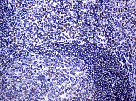 JUN / c-Jun Antibody - Immunohistochemical staining of paraffin-embedded Human tonsil using anti-JUN mouse monoclonal antibody.  heat-induced epitope retrieval by 10mM citric buffer, pH6.0, 120C for 3min)