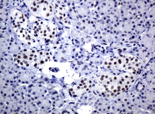 JUN / c-Jun Antibody - Immunohistochemical staining of paraffin-embedded Human pancreas tissue using anti-JUN mouse monoclonal antibody.  heat-induced epitope retrieval by 10mM citric buffer, pH6.0, 120C for 3min)