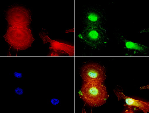 JUN / c-Jun Antibody - Immunofluorescent staining of HeLa cells using JUN mouse monoclonal antibody  green). Actin filaments were labeled with TRITC-phalloidin. (red), and nuclear with DAPI. (blue). The three-color overlay image is located at the bottom-right corner.