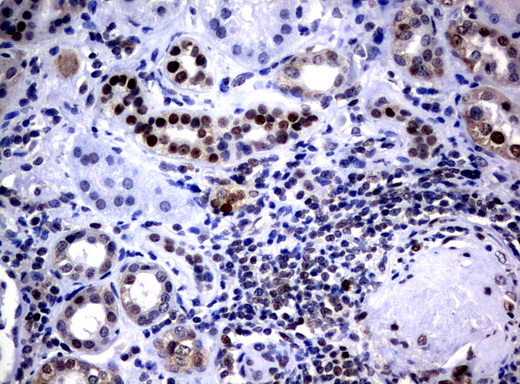 JUN / c-Jun Antibody - Immunohistochemical staining of paraffin-embedded Human Kidney tissue using anti-JUN mouse monoclonal antibody.  heat-induced epitope retrieval by 10mM citric buffer, pH6.0, 120C for 3min)