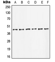 JUN / c-Jun Antibody - Western blot analysis of c-Jun expression in HeLa (A); U2OS (B); HCT116 (C); NIH3T3 (D); PC12 (E); rat kidney (F) whole cell lysates.