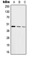 JUN / c-Jun Antibody - Western blot analysis of c-Jun expression in HeLa (A); mouse kidney (B); PC12 (C) whole cell lysates.