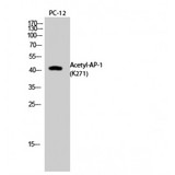 JUN / c-Jun Antibody - Western blot of Acetyl-AP-1 (K271) antibody