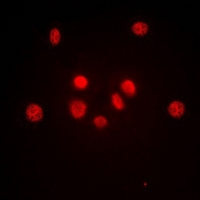 JUN / c-Jun Antibody - Immunofluorescent analysis of c-Jun staining in HeLa cells. Formalin-fixed cells were permeabilized with 0.1% Triton X-100 in TBS for 5-10 minutes and blocked with 3% BSA-PBS for 30 minutes at room temperature. Cells were probed with the primary antibody in 3% BSA-PBS and incubated overnight at 4 deg C in a humidified chamber. Cells were washed with PBST and incubated with a DyLight 594-conjugated secondary antibody (red) in PBS at room temperature in the dark. DAPI was used to stain the cell nuclei (blue).