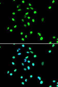 JUN / c-Jun Antibody - Immunofluorescence analysis of A549 cells.