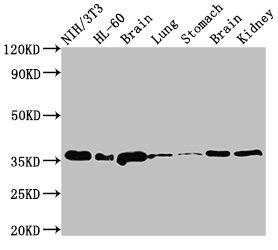 JUN / c-Jun Antibody - Positive Western Blot detected in NIH/3T3 whole cell lysate, HL-60 whole cell lysate, Rat brain tissue, Rat lung tissue, Rat stomach tissue, Mouse brain tissue, Mouse kidney tissue. All lanes: JUN antibody at 3 µg/ml Secondary Goat polyclonal to rabbit IgG at 1/50000 dilution. Predicted band size: 36 KDa. Observed band size: 36 KDa