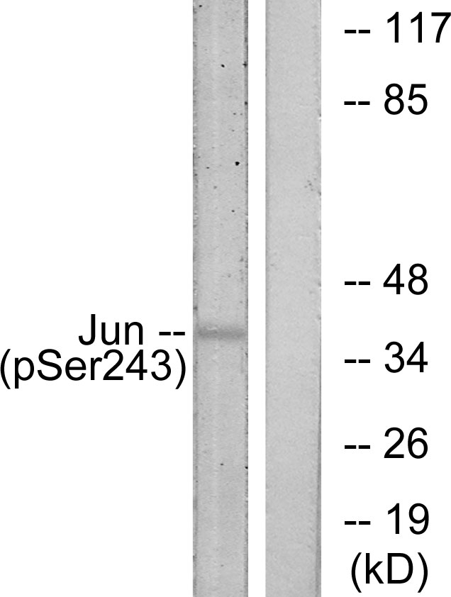 JUN / c-Jun Antibody - Western blot analysis of lysates from HeLa cells treated with UV, using c-Jun (Phospho-Ser243) Antibody. The lane on the right is blocked with the phospho peptide.