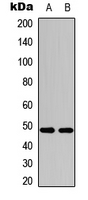 JUN / c-Jun Antibody - Western blot analysis of c-Jun (pS243) expression in HEK293T UV-treated (A); RAW264.7 UV-treated (B) whole cell lysates.