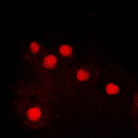 JUN / c-Jun Antibody - Immunofluorescent analysis of c-Jun (pS243) staining in HEK293T cells. Formalin-fixed cells were permeabilized with 0.1% Triton X-100 in TBS for 5-10 minutes and blocked with 3% BSA-PBS for 30 minutes at room temperature. Cells were probed with the primary antibody in 3% BSA-PBS and incubated overnight at 4 deg C in a humidified chamber. Cells were washed with PBST and incubated with a DyLight 594-conjugated secondary antibody (red) in PBS at room temperature in the dark. DAPI was used to stain the cell nuclei (blue).
