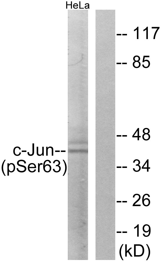 JUN / c-Jun Antibody - Western blot analysis of lysates from HeLa cells treated with UV, using c-Jun (Phospho-Ser63) Antibody. The lane on the right is blocked with the phospho peptide.