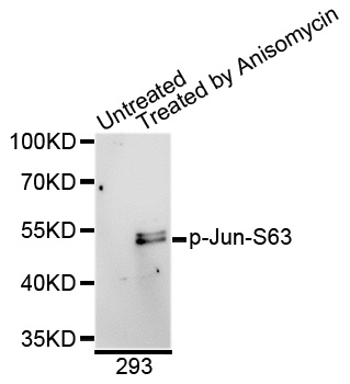 JUN / c-Jun Antibody - Western blot analysis of extracts of 293 cells.